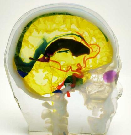 3D打印全彩軟性透明樹脂醫(yī)療模型